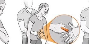 Heimlich Manevrası Nasıl Yapılır?