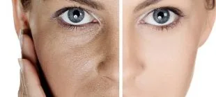 Cilt Beyazlatan ve Güzelleştiren En Etkili 3 Doğal Maske