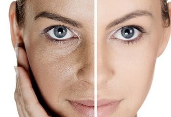 Cilt Beyazlatan ve Güzelleştiren En Etkili 3 Doğal Maske