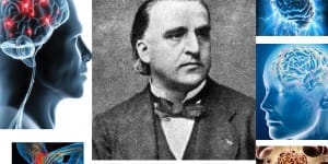 Jean Martin Charcot Kimdir