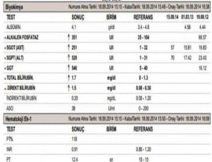 alt-nedir-ve-neden-yukselir