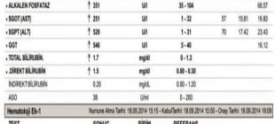 ALT Nedir ve Neden Yükselir