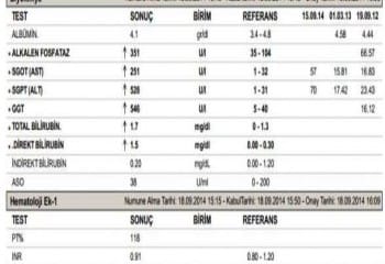 ALT Nedir ve Neden Yükselir