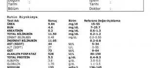 AST Nedir ve Neden Yükselir