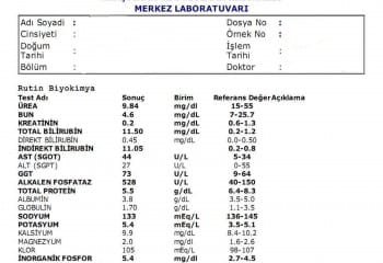 AST Nedir ve Neden Yükselir