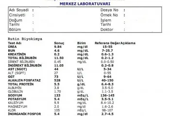 AST Nedir ve Neden Yükselir
