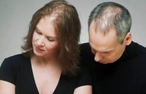 sac-dokulmesi-neden-olur