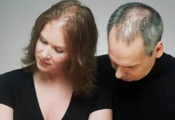 Saç Dökülmelerine Neden Olan 5 Hata