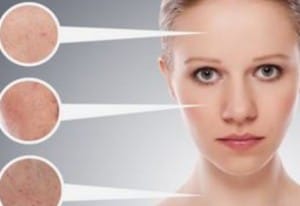 isik-peeling-nasil-yapilir