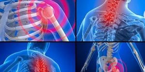Fibromiyalji Nedir