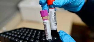 MPV Nedir, Neden Yükselir ve Düşer