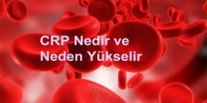 CRP Nedir ve Neden Yükselir