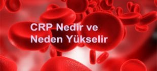 CRP Nedir ve Neden Yükselir