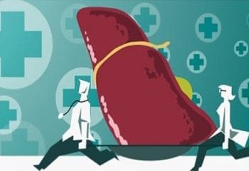 Karaciğer Yağlanmasına Karşı 10 Süper Besin