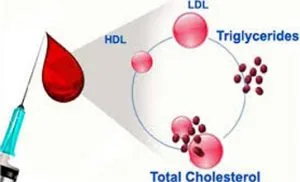 total-kolestrol