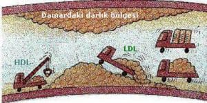 ldl-nedir