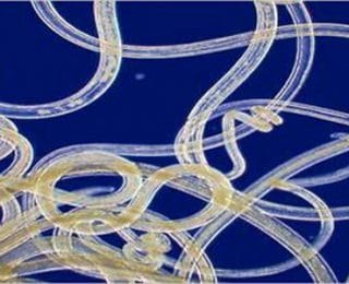 Bağırsak kurdu Nedir ve Belirtileri Nelerdir