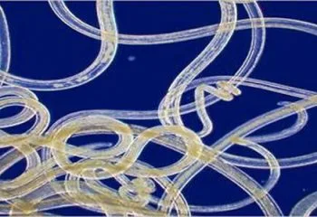 Bağırsak kurdu Nedir ve Belirtileri Nelerdir