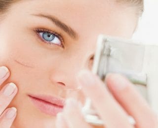 Yara İzlerini Giderecek En İyi Kremler