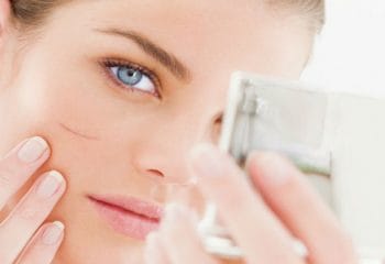 Yara İzlerini Giderecek En İyi Kremler