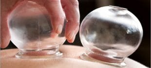 Hacamat Nedir ve Faydaları Nelerdir