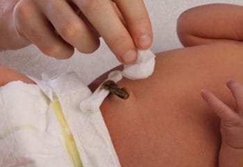 Bebeklerde Göbek Bağı Bakımı Nasıl Yapılır