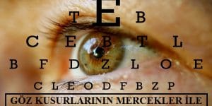 Işığın Kırılması ve Mercekler-4: Mercekler ile Göz Kusurlarının Giderilmesi