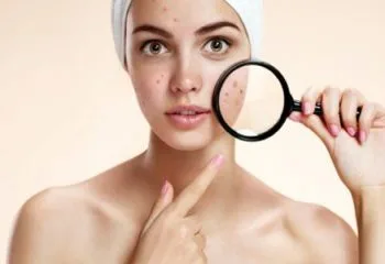 Ciltteki Güneş Lekelerine Kesin Çözüm