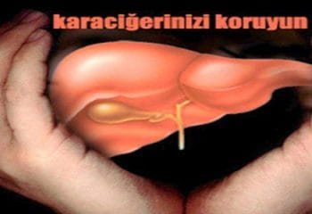 Karaciğer Yağlanmasına Doğal ve Etkili Hızlı Çözüm