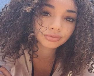 1 Ayda Sivilcelerden Kurtaran Denenmiş ve Faydası Görülmüş Karışım