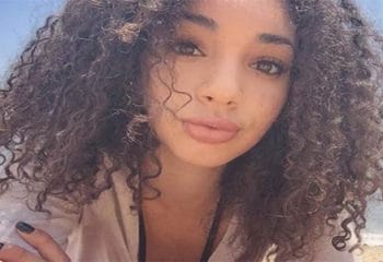 1 Ayda Sivilcelerden Kurtaran Denenmiş ve Faydası Görülmüş Karışım