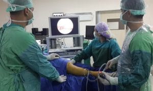 Artroskopi Nedir ve Kullanım Alanları