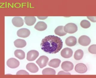 Eozinofil (EOS) Nedir ve EOS Neden Yükselir veya Düşer