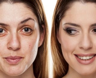 Kırışıklıktan Kurtulmak İçin Doğal Çözümler