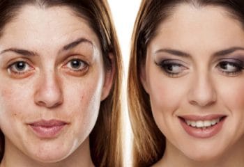 Kırışıklıktan Kurtulmak İçin Doğal Çözümler