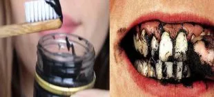 Dişlerdeki Kahve ve Sigara Lekelerini Yok Eden Doğal Yöntem