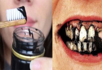 Dişlerdeki Kahve ve Sigara Lekelerini Yok Eden Doğal Yöntem
