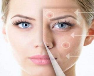 Cilt Kırışıklıklarını Önlemek İçin Hyaluronik Asit’in Önemi