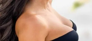 Meme Estetiği Nedir ve Meme Estetiği Çeşitleri Nelerdir?