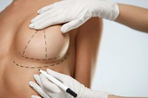 Meme estetiği Nedir Meme Estetiği çeşitleri nelerdir?