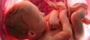 Hamilelik Döneminde Bebeğin Kalp Atışları Ne Zaman Belli Olur