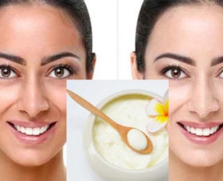 Cildinizi 1 Gecede Beyazlatan Mucize Maske Tarifi