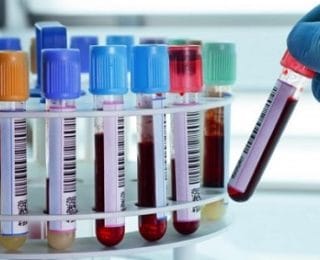 Kan Değerleri ve Anlamları Nedir