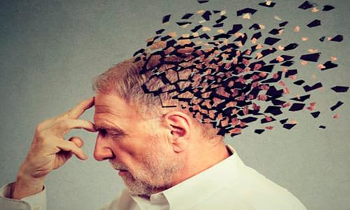 Alzheimer’ın 10 Belirtisi ve Korunma Yöntemleri, Alzheimer Bitkisel Tedavisi