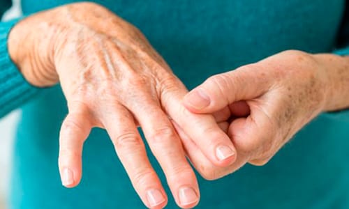 Romatizma Ağrılarına Bitkisel Çözüm