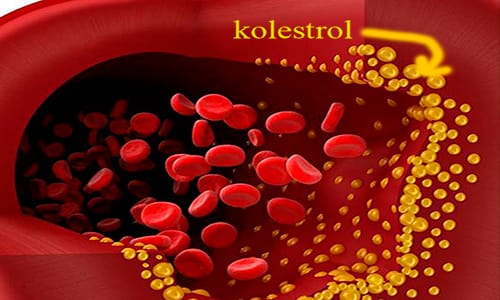 Kolesterol Nedir