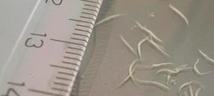 Kıl Kurdu Nedir, Nasıl Bulaşır, Belirtileri ve Tedavi Yöntemleri Nelerdir