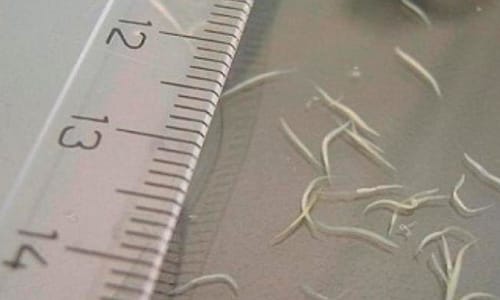 Kıl Kurdu Nedir, Nasıl Bulaşır, Belirtileri ve Tedavi Yöntemleri Nelerdir