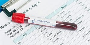 Kan Testindeki Değerlerin Anlamı