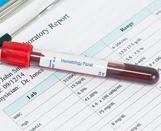 Kan Testindeki Değerlerin Anlamı